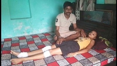The victim resting at home after receiving first aid in Jamalpur area of Ludhiana on Friday. (HT photo) The victim resting at home after receiving first aid in Jamalpur area of Ludhiana on Friday. (HT photo)