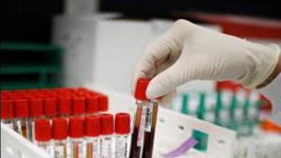 Through July, 11 people have succumbed to the virus in the tricity, including eight in Mohali, two in Panchkula and one in Chandigarh. (REUTERS)