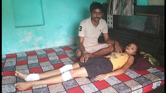 The victim resting at home after receiving first aid in Jamalpur area of Ludhiana on Friday. (HT photo)