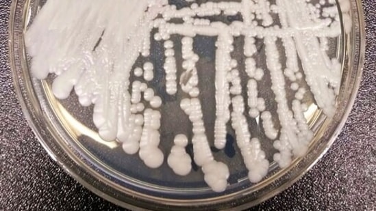 The photo shows a strain of Candida auris cultured in a petri dish at a CDC laboratory.(AP)