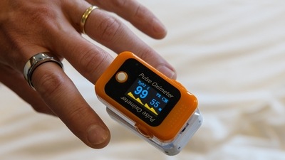 The imported brand of pulse oximeter showed a reduction of ₹2,95,375 per unit, the ministry of chemicals and fertilizers said. (AFP Photo) The imported brand of pulse oximeter showed a reduction of ₹2,95,375 per unit, the ministry of chemicals and fertilizers said. (AFP Photo)