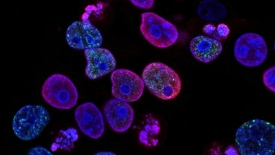 New research sheds light on identical mutations causing different type of cancer (Unsplash) New research sheds light on identical mutations causing different type of cancer (Unsplash)