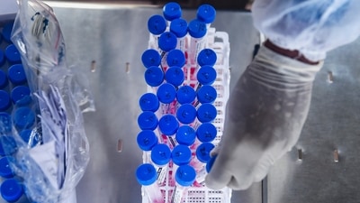 The pharma company said that it has applied to the DCGI for restricted emergency-use authorisation to manufacture drug 2-DG for the treatment of Covid-19 patients in the country. (PTI Photo) The pharma company said that it has applied to the DCGI for restricted emergency-use authorisation to manufacture drug 2-DG for the treatment of Covid-19 patients in the country. (PTI Photo)