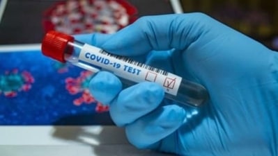 Latest study suggests that inflammation and blood clots in severe Covid cases are linked to abnormal antibody response. (File image) Latest study suggests that inflammation and blood clots in severe Covid cases are linked to abnormal antibody response. (File image)