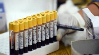 A sero survey shows if a person had been exposed to Covid-19 and if antibodies were being produced in the individual's system. (Raj K Raj/HT file photo. Representative image)