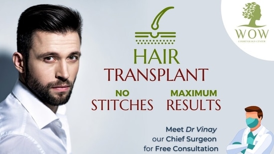 Choosing the right hair transplant clinic - Hindustan Times Choosing the right hair transplant clinic - Hindustan Times