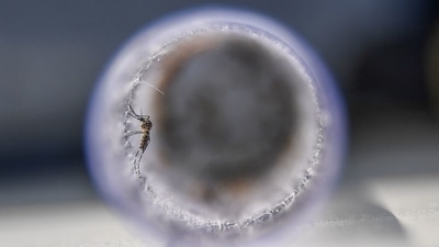 Zika can be transmitted through mosquito bites, from a pregnant woman to her foetus, through sexual contact and transfusion of blood and blood products, and organ transplantation. (AFP Photo) Zika can be transmitted through mosquito bites, from a pregnant woman to her foetus, through sexual contact and transfusion of blood and blood products, and organ transplantation. (AFP Photo)