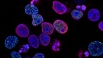 Studying DNA tags can lead to better understanding of cancer treatment outcomes(Unsplash) Studying DNA tags can lead to better understanding of cancer treatment outcomes(Unsplash)