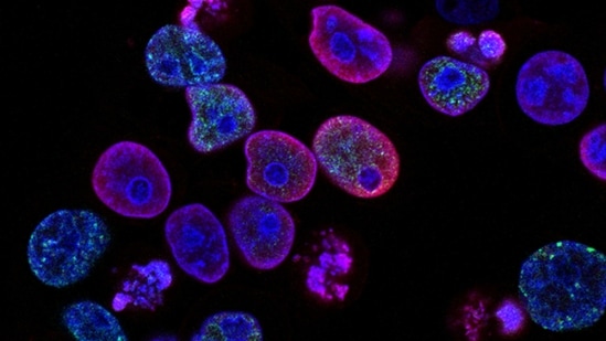 Studying DNA tags can lead to better understanding of cancer treatment outcomes(Unsplash) Studying DNA tags can lead to better understanding of cancer treatment outcomes(Unsplash)