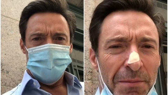 Hugh Jackman undergoes skin biopsy on his nose, urges fans to wear  sunscreen: 'Don't be like me as a kid' | Hollywood - Hindustan Times