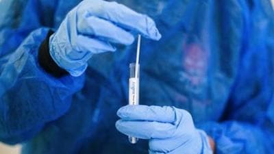 So far, 3,17,627 people have recovered from the virus, prompting the recovery rate to reach 98.23% (Bloomberg)
