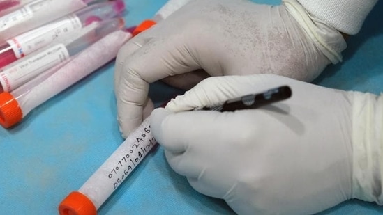 Allegations of fake testing surfaced at the Kumbh after a Faridkot resident complained to the authorities that he received a message for collecting his Covid report despite never having been tested.(Bloomberg file photo. Representative image)