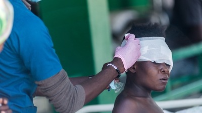 An injured woman is treated at a hospital in Les Cayes on August 15, 2021, after a 7.2-magnitude earthquake struck the southwest peninsula of Haiti. (AFP) An injured woman is treated at a hospital in Les Cayes on August 15, 2021, after a 7.2-magnitude earthquake struck the southwest peninsula of Haiti. (AFP)