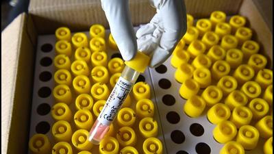 Around 3,000 samples are to be collected from Gurugram for the statewide serological survey. (Vipin Kumar/HT PHOTO) Around 3,000 samples are to be collected from Gurugram for the statewide serological survey. (Vipin Kumar/HT PHOTO)