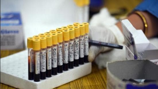 The sero-survey, which examines how many people in a population have been infected with Covid-19 and recovered, is conducted by using an antibody test, also known as a serology test. (HT File Photo)