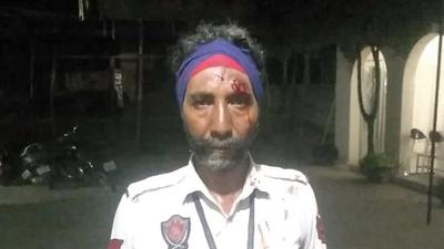 Injured traffic police personnel Jasveer Singh after a scuffle with a commuter in Ludhiana on Wednesday. (HT PHOTO)