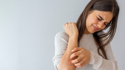 Stay protected from the attack of mosquitoes. (Shutterstock)