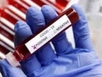 The drugs control department advisory lists eight medicines of different doses, including the steroid dexamethasone, antiviral medicine remdesivir, immune modulator tocilizumab, and antifungal drugs amphotericin B and posaconazol. The drugs control department advisory lists eight medicines of different doses, including the steroid dexamethasone, antiviral medicine remdesivir, immune modulator tocilizumab, and antifungal drugs amphotericin B and posaconazol.