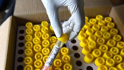 Following the increase in Covid-19 cases in Kerala, the state government had imposed strict regulations for passengers coming from Maharashtra and Kerala, including mandatory RT-PCR test reports. (HT File) Following the increase in Covid-19 cases in Kerala, the state government had imposed strict regulations for passengers coming from Maharashtra and Kerala, including mandatory RT-PCR test reports. (HT File)