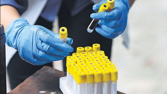 A health worker holds blood samples taken from local residents at a serological survey site. (Bloomberg)