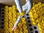 Till Tuesday evening, 3.57 million people in Delhi were fully vaccinated and another 5.47 million partly vaccinated.(HT Photo) Till Tuesday evening, 3.57 million people in Delhi were fully vaccinated and another 5.47 million partly vaccinated.(HT Photo)