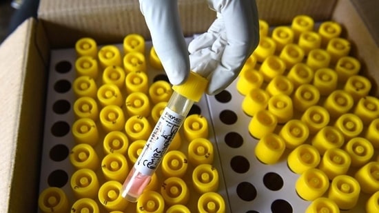 Till Tuesday evening, 3.57 million people in Delhi were fully vaccinated and another 5.47 million partly vaccinated.(HT Photo) Till Tuesday evening, 3.57 million people in Delhi were fully vaccinated and another 5.47 million partly vaccinated.(HT Photo)