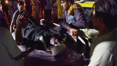 Medical and hospital staff bring an injured man on a stretcher for treatment after two blasts, which killed at least five and wounded a dozen, outside the airport in Kabul. (AFP) Medical and hospital staff bring an injured man on a stretcher for treatment after two blasts, which killed at least five and wounded a dozen, outside the airport in Kabul. (AFP)