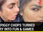 Priyanka Chopra hurt on sets of Citadel