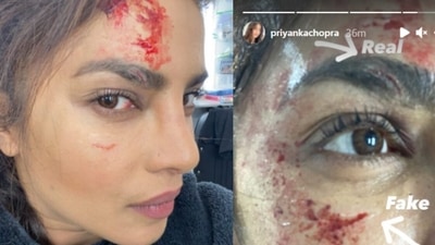 Priyanka Chopra gets hurt during the making of Citadel. Priyanka Chopra gets hurt during the making of Citadel.