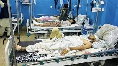 Wounded people lie on beds at a hospital after a deadly attack outside the airport in Kabul. (AP Photo)