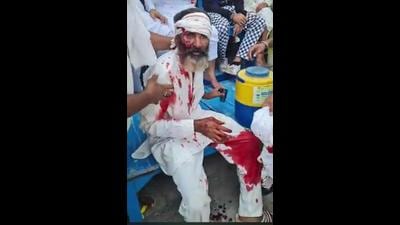 An injured farmer after the police lathicharge at Bastara toll plaza near Karnal on Saturday. (HT Photo)