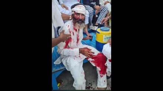 An injured farmer after the police lathicharge at Bastara toll plaza near Karnal on Saturday. (HT Photo)