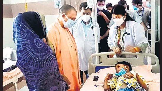 UP CM Yogi Adityanath visits children suffering from mystery viral disease in Firozabad.