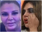 Rakhi Sawant shared a video about her nose surgery. Rakhi Sawant shared a video about her nose surgery.