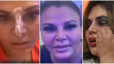 Rakhi Sawant shared a video about her nose surgery.