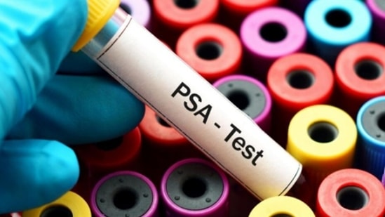The PSA test is a blood test used primarily to screen for prostate cancer.(Instagram)