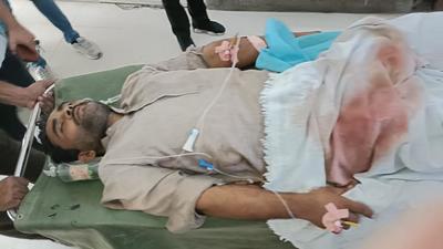 The Pakistani intruder, who received a bullet wound in the thigh, being treated at the civil hospital in Ferozepur on Thursday. (HT Photo)