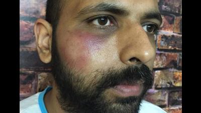 Head constable Varun Kapoor showing his bruised face. Head constable Varun Kapoor showing his bruised face.