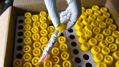 Chief medical officer of Gurugram, Dr Virender Yadav, said that children have been included in the sero survey over apprehensions that they might be affected the most in the event of a third wave of Covid-19 infections, as inoculation has not started for them. (HT Archive) Chief medical officer of Gurugram, Dr Virender Yadav, said that children have been included in the sero survey over apprehensions that they might be affected the most in the event of a third wave of Covid-19 infections, as inoculation has not started for them. (HT Archive)