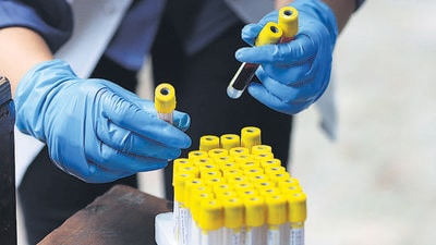 Samples from 5,663 persons, including 2,077 police personnel, healthcare workers and pregnant women were taken in the sero survey conducted in Kashmir in July 2021. (Bloomberg) Samples from 5,663 persons, including 2,077 police personnel, healthcare workers and pregnant women were taken in the sero survey conducted in Kashmir in July 2021. (Bloomberg)