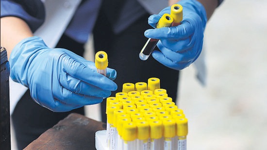Samples from 5,663 persons, including 2,077 police personnel, healthcare workers and pregnant women were taken in the sero survey conducted in Kashmir in July 2021. (Bloomberg) Samples from 5,663 persons, including 2,077 police personnel, healthcare workers and pregnant women were taken in the sero survey conducted in Kashmir in July 2021. (Bloomberg)