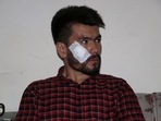 An injured journalist looks on after being beaten by the Taliban in Kabul, Afghanistan, on September 8, 2021, in this picture obtained from social media.&nbsp;