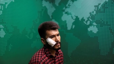 Nematullah Naqdi, a journalist, was ruthlessly beaten by the Taliban for covering the women’s protest in Kart-e-Char area of western Kabul. (REUTERS)