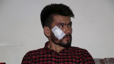 An injured journalist looks on after being beaten by the Taliban in Kabul, Afghanistan, on September 8, 2021, in this picture obtained from social media.&nbsp; (Etilaatroz / via REUTERS)