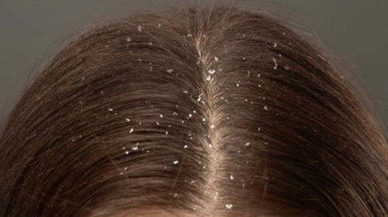 He recommends the use of Ayurvedic ingredients like Dashamoola, Triphala, Methi, Curry Leaves, Brahmi, Bakuchi, Mulethi, Methi, Shikakai that could help nurture the overall scalp and hair health.(Instagram)