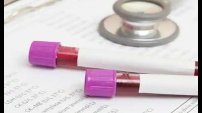 The district administration’s initiative to cap prices of dengue tests is an outcome of several complaints related to overpricing by laboratories. (Pic for representation) The district administration’s initiative to cap prices of dengue tests is an outcome of several complaints related to overpricing by laboratories. (Pic for representation)