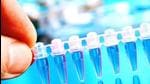 Around 85% proteins are considered “undruggable” because scientists haven’t been able to get any candidate drug to stick to them well. (Representational Image) Around 85% proteins are considered “undruggable” because scientists haven’t been able to get any candidate drug to stick to them well. (Representational Image)