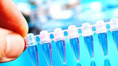 Around 85% proteins are considered “undruggable” because scientists haven’t been able to get any candidate drug to stick to them well. (Representational Image) Around 85% proteins are considered “undruggable” because scientists haven’t been able to get any candidate drug to stick to them well. (Representational Image)