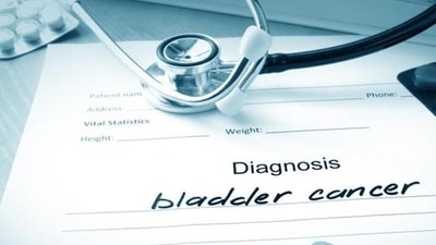 Frequent and painful urination is one of the symptoms of bladder cancer. (Instagram) Frequent and painful urination is one of the symptoms of bladder cancer. (Instagram)