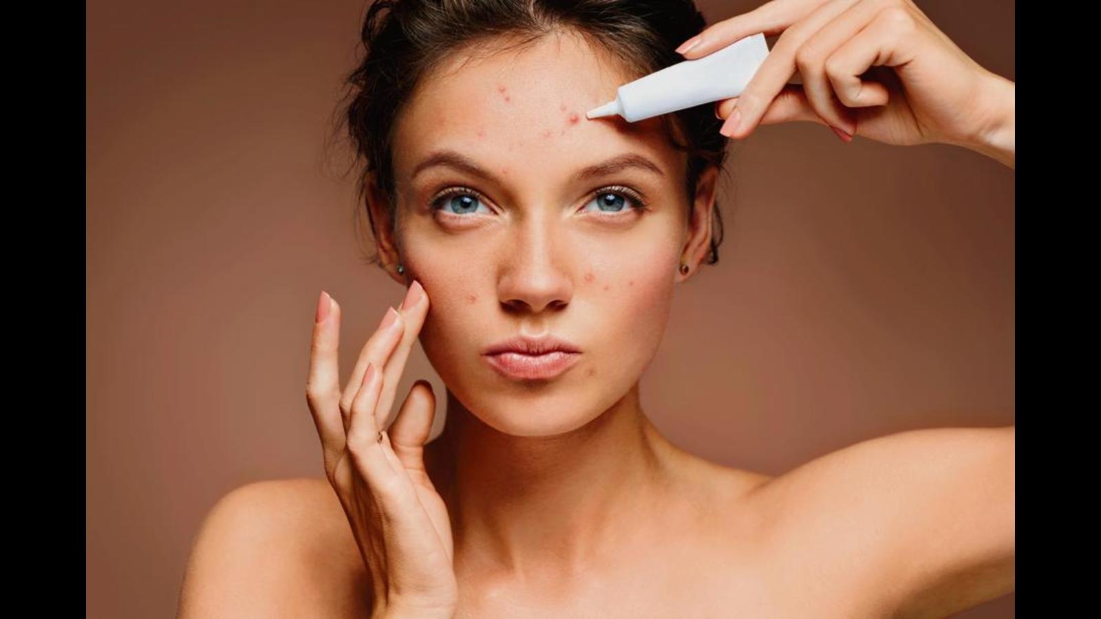 Radiant in rains Combat monsoon acne Health Hindustan Times